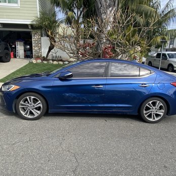 Before repair - Irvine vehicle damage